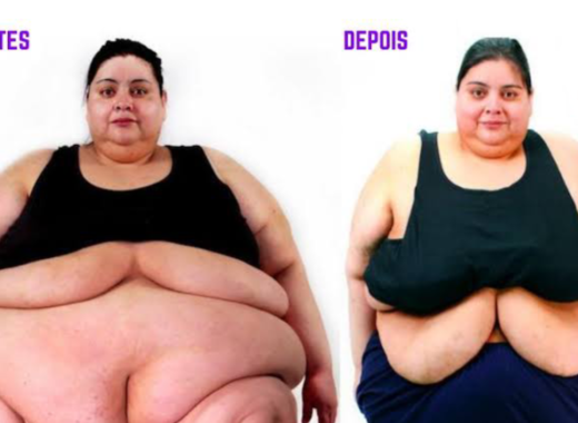 Um antes e depois da Karina. À esquerda ela está com quase 300kg e à direita já próxima dos seus 180kg.